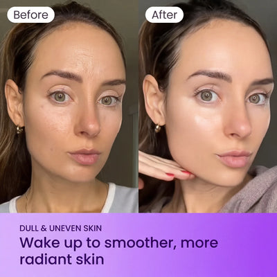 Yoori 3D Full Face Lifting Mask