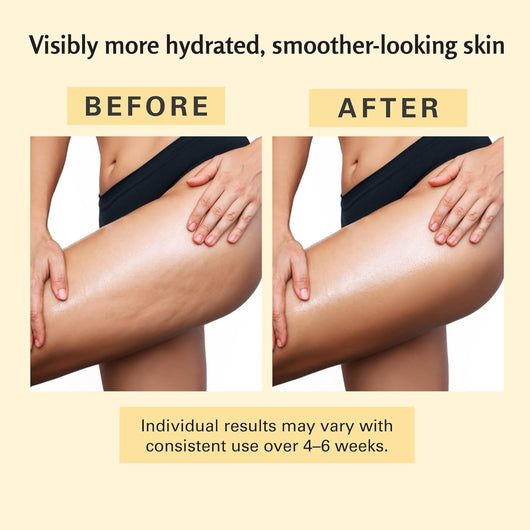 Yoori Anti-Cellulite Massage Oil