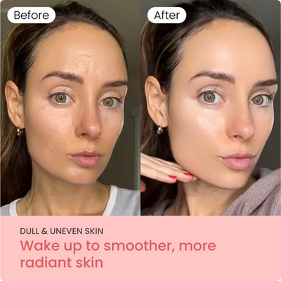 Yoori 3D Full Face Lifting Mask