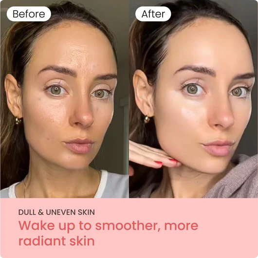 Yoori 3D Full Face Lifting Mask